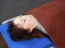 ハヤ治療院(HAYA治療院)/リラックスして受けられる美容鍼