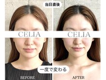 セリア(CELIA)