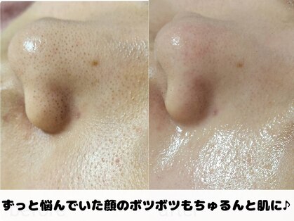 リノリノ(LinoLino)の写真