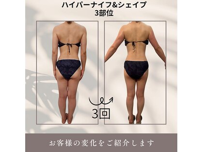 コリ チル(Kori Chill)の写真