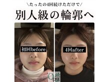 キュープ 高崎店(Qpu)/小顔頭蓋骨矯正＋オイルケア