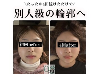 キュープ 高崎店(Qpu)/小顔頭蓋骨矯正＋オイルケア