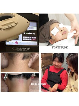 フォーティチュード(FORTITUDE)/FORTITUDEのキッズ脱毛