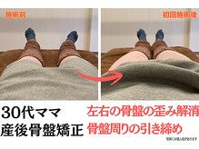 ニノ治療院(Nino治療院)/産後骨盤矯正で下半身の引き締め