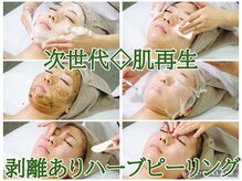 リンダ(Rinda)/ハクリ有◇ハーブピーリング