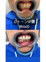 アイブロウ33/ホワイトニング　