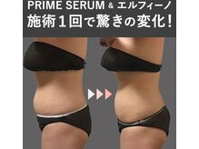 蓮子の夢