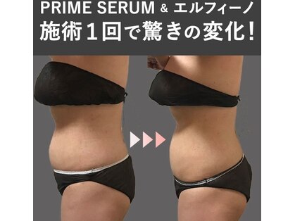蓮子の夢の写真