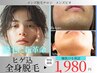 《初回限り》1回でも効果実感!ヒゲ込全身脱毛トライアル【カウ着替込60分】