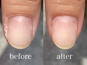 コフレ 千歳烏山(Coffret)/gel care ¥0