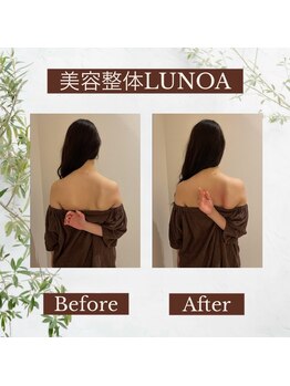 美容整体LUNOA　神戸三宮院/[三ノ宮/美容整体/整体/肩こり]