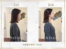 シルク(SILK)の雰囲気（Point 2 小顔だけでなく「頭」「顔の歪み」「姿勢」まで整える♪）