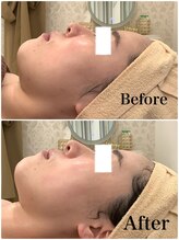 スペチアーレ 夙川/横顔まで美しく