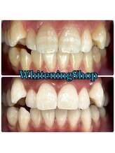 ホワイトニングショップ 吉祥寺2号店/老若男女、施術間歓迎