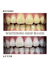 ホワイトニングショップ 新小岩店/ホワイトニング専門店