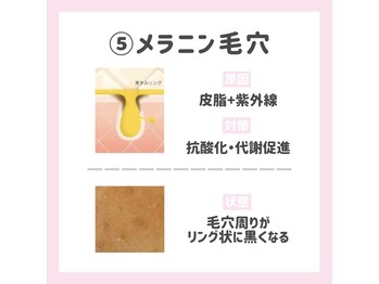 ポアレスラボ 新宿マルイ本館店/黒ずみ毛穴