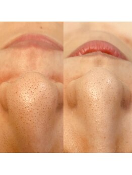 グラント ふじみ野店(grant)/