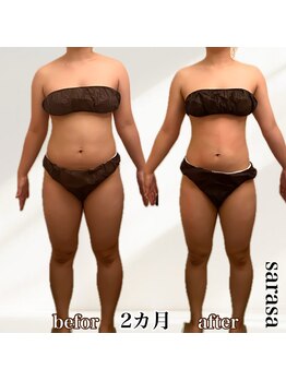 ナチュラル ビューティー スタイル さらさ(Natural Beauty Style)/さらさ痩身プログラム2カ月