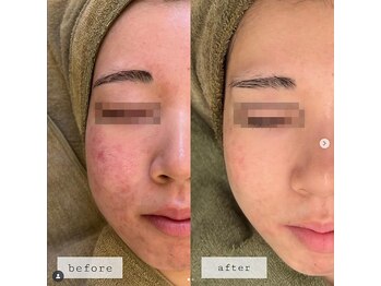 エステティックサロンR/