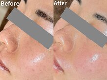 ミエル(Miel)の雰囲気（【白玉WAX】毛穴ケア×ツヤ肌へ）