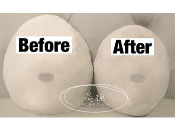 美極 トータルビューティー(美極 TOTAL BEAUTY)/恵比寿/小顔コルギ/エステ/