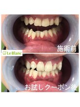 ルブラン 奈良店(Le Blanc)/特別に