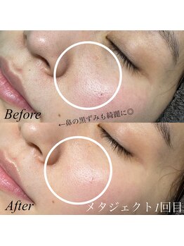 パリスエリー(PARIS ELLY)/メタジェクト☆