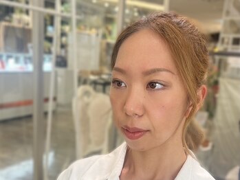 ビューティーガーデン イース/AFTER