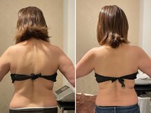 プライベートエステティックサロン クール(Coeur)/【脂肪燃焼/上半身デトックス】