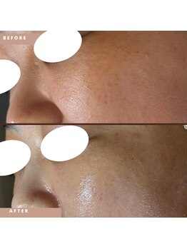 ラヴィン/ツヤ玉へ