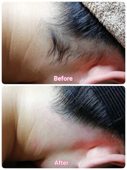 ベイジョ デ アンジョ(Beijo de anjo)/うなじシュガーリング