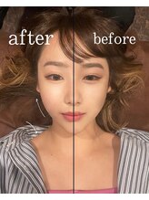 ニクス(nyx)/施術前→施術後