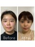 《何度も使える》左右差/歪みに◎独自メソッドの小顔矯正　￥15000
