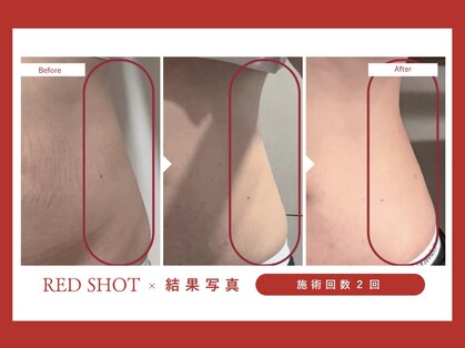 リーインカーナ アーティスト(REINCARNA ARTIST)の写真