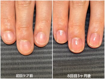 エムズ(m's)/【自爪育成】３ヶ月コース