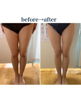 フィカス(FICUS)/なかなか落ちない太ももも