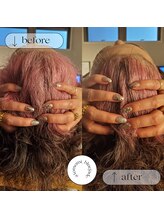 ブルー ジェイド(BLUE JADE)/筋膜リリースbefore　after