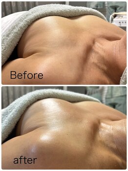 ベッピン(Beppin)/バストケア/下垂ケア/バスト静岡