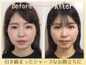 【平日限定 学割U24】むくみ・エラ張りをキュっと小顔矯正60分4500円→3000円