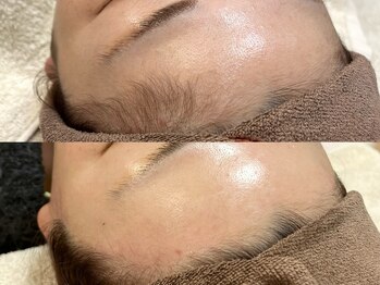 アルム(a'lm)/フェイシャルワックス/生え際WAX