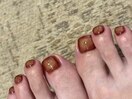 囲みグラデーション ストーン