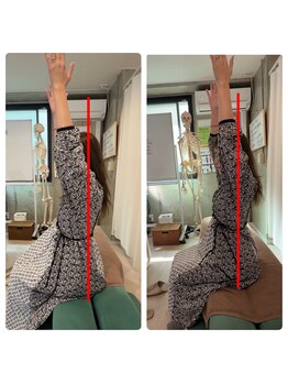 香椎井上整骨 整体院/肩こり・首こり・頭痛を根本改善