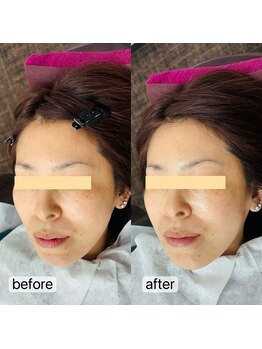 トゥインクル(Twinkle)/キュッと引き上げ!