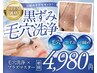 OPEN価格★【黒ずみ毛穴×引き締めケア】毛穴洗浄＋プラズマ　初回¥4980