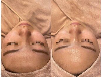 ビュウナ 銀座(BEAUNA)/シルクブライト