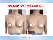 エトワールの雰囲気（盛りブラで小さくなったバストが真ん丸美乳に大成長♪）