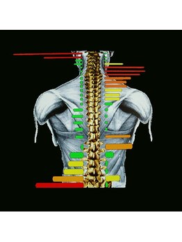 つかはらカイロプラクティック/カイロの本場アメリカの歪み測定