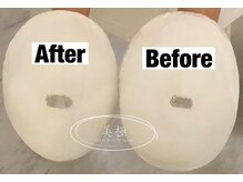 美極 トータルビューティー(美極 TOTAL BEAUTY)/恵比寿/小顔コルギ/エステ/