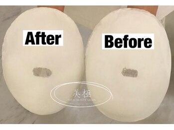 美極 トータルビューティー(美極 TOTAL BEAUTY)/恵比寿/小顔コルギ/エステ/