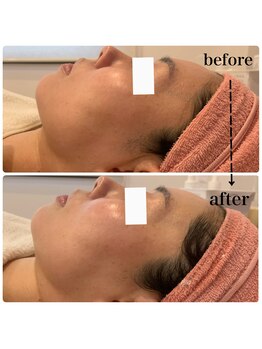 ジョアアンジェ 京橋店(joie ange)/透明感UP